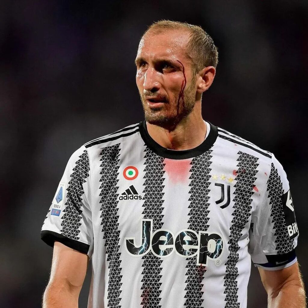 Georgio Chiellini